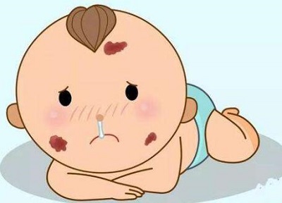 哪些外部因素会影响到胎记患者的病情？