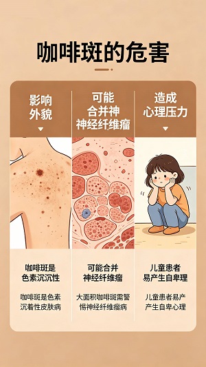 南京咖啡斑资讯一览：咖啡斑治疗起来困难吗？